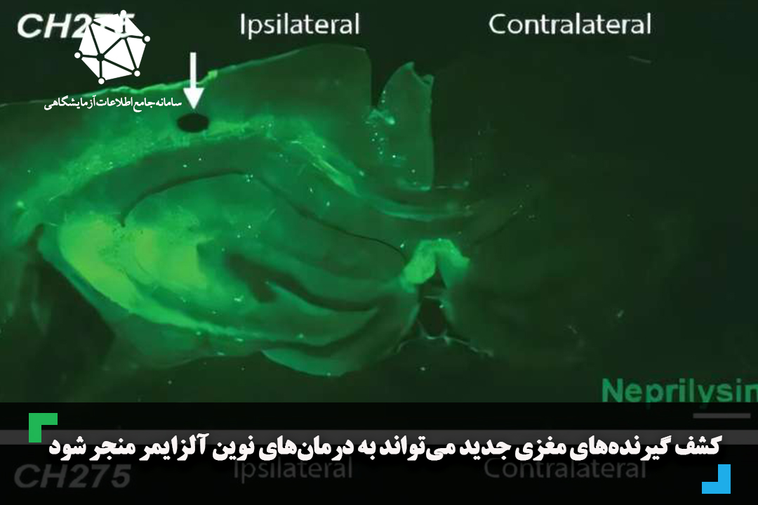 کشف گیرنده‌های مغزی جدید می‌تواند به درمان‌های نوین آلزایمر منجر شود