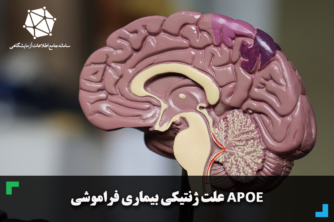 APOE علت ژنتیکی بیماری فراموشی