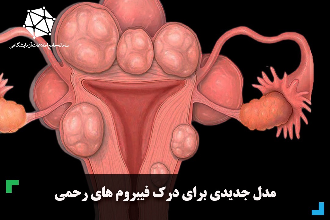 مدل جدیدی برای درک فیبروم های رحمی