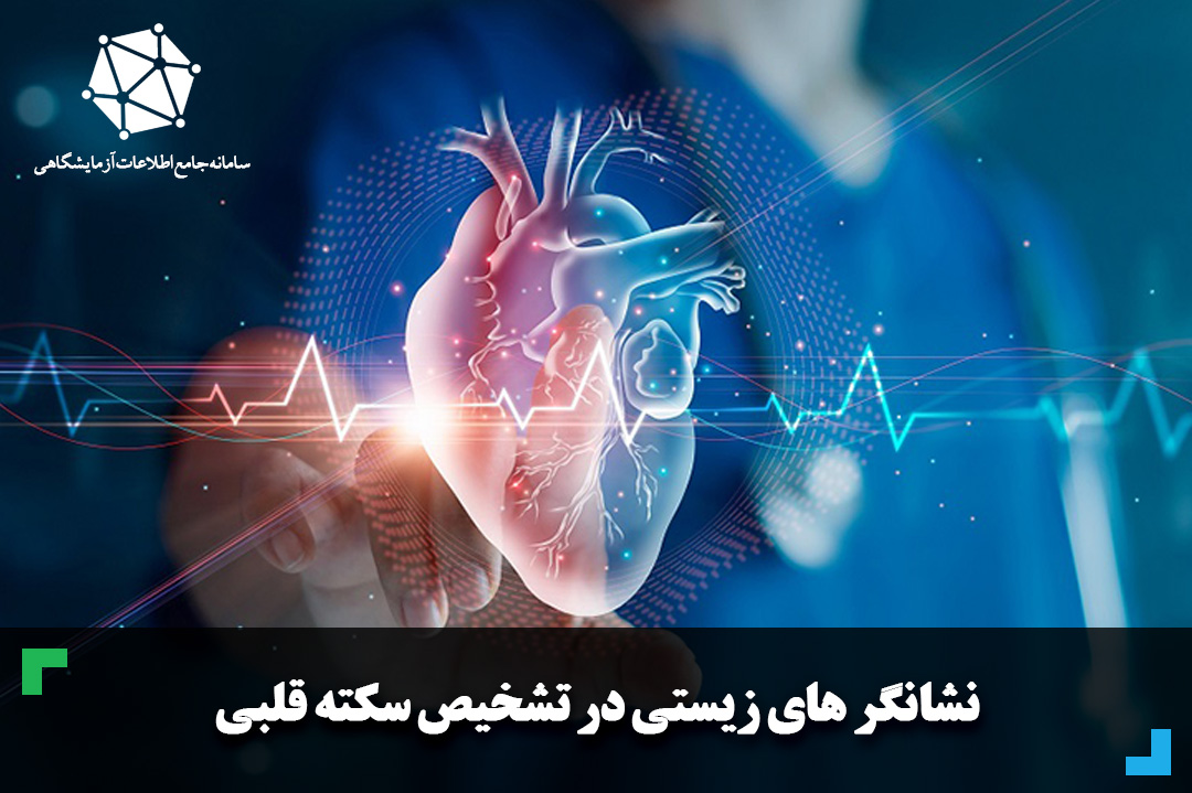 نشانگر های زیستی در تشخیص سکته قلبی