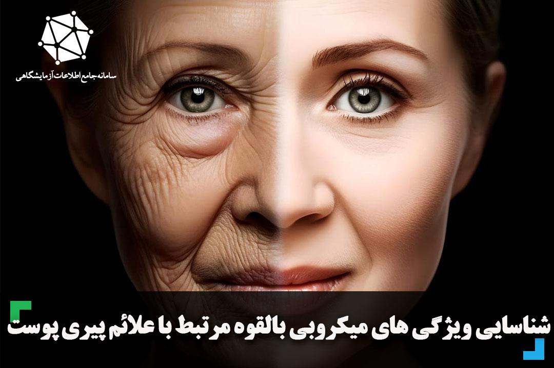 شناسایی ویژگی های میکروبی بالقوه مرتبط با علائم پیری پوست