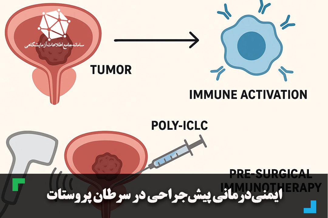 ایمنی‌درمانی پیش‌جراحی در سرطان پروستات
