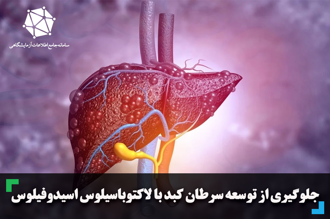 جلوگیری از توسعه سرطان کبد با لاکتوباسیلوس اسیدوفیلوس