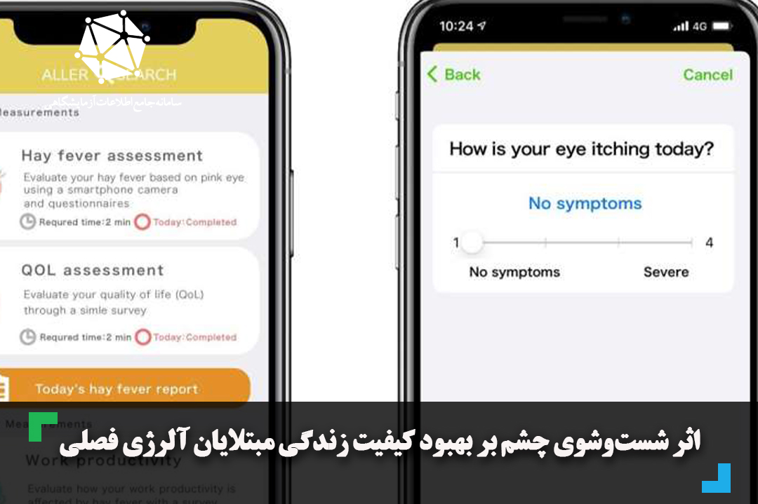 اثر شست‌وشوی چشم بر بهبود کیفیت زندگی مبتلایان آلرژی فصلی