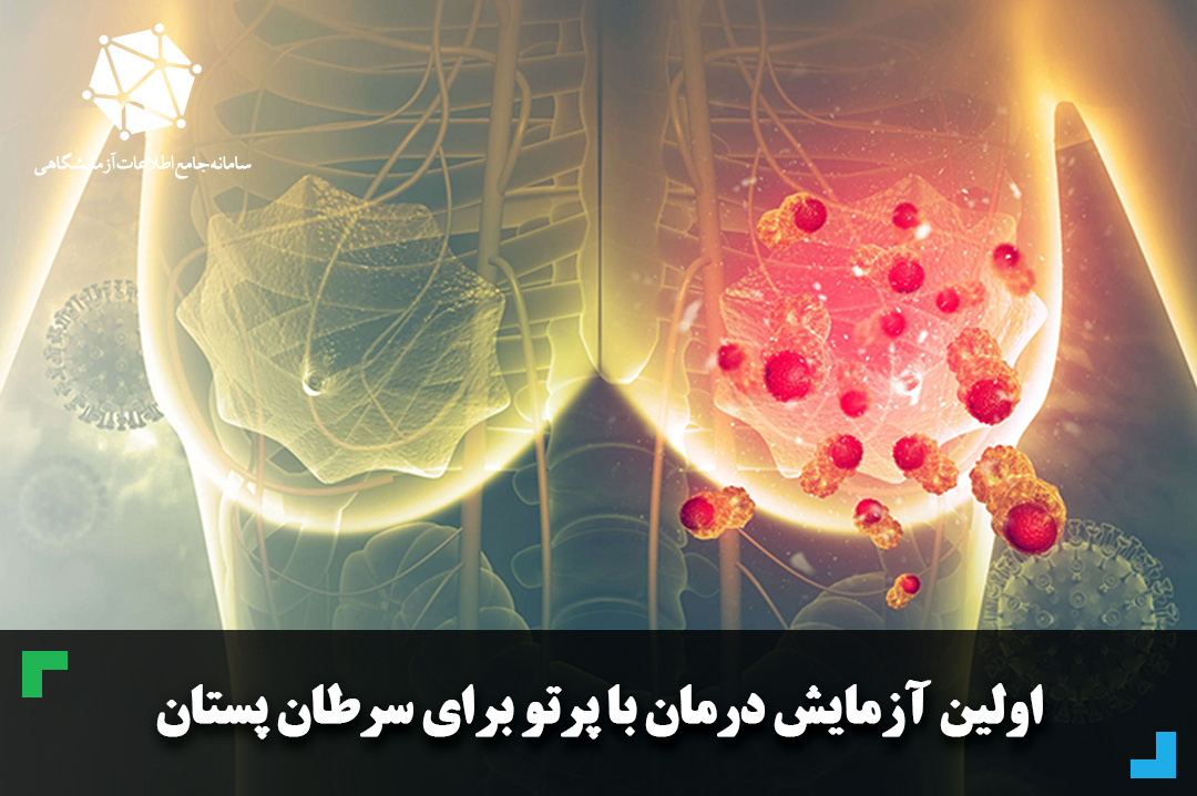 اولین آزمایش درمان با پرتو برای سرطان پستان