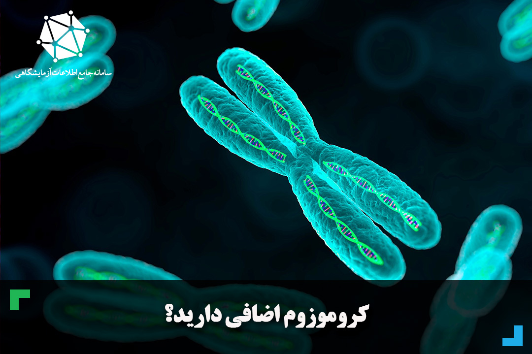 کروموزوم اضافی دارید؟