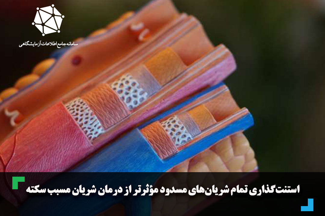 استنت‌گذاری تمام شریان‌های مسدود مؤثرتر از درمان شریان مسبب سکته