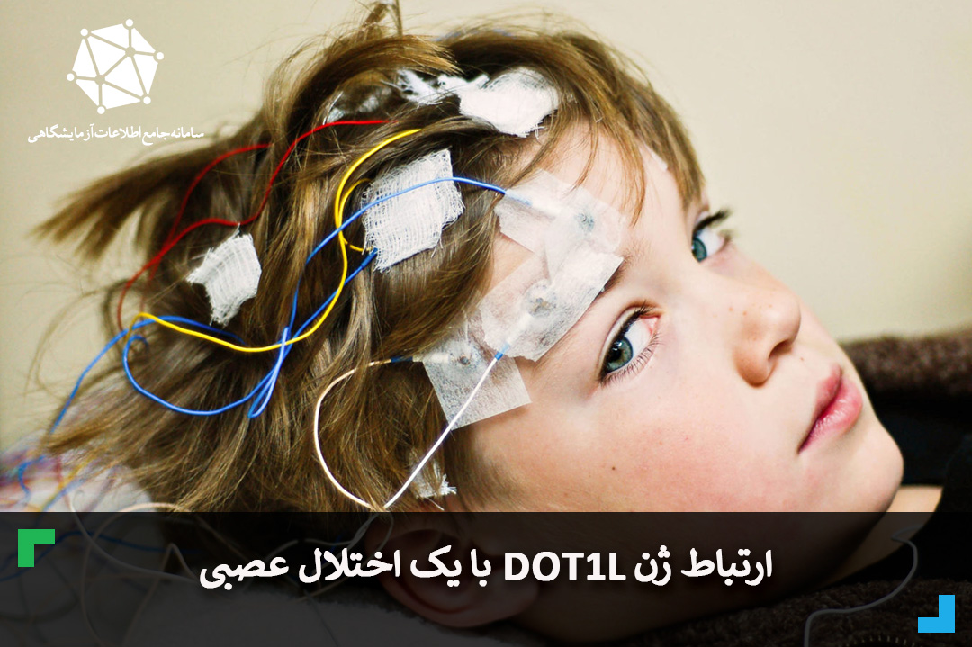 ارتباط ژن DOT1L با یک اختلال عصبی