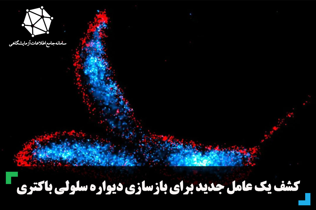 کشف یک عامل جدید برای بازسازی دیواره سلولی باکتری