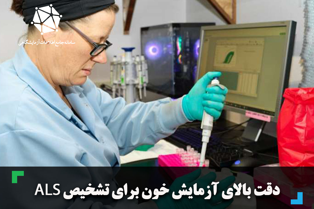 دقت بالای آزمایش خون برای تشخیص ALS