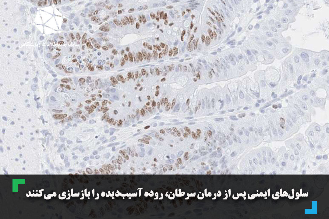 سلول‌های ایمنی پس از درمان سرطان، روده آسیب‌دیده را بازسازی می‌کنند