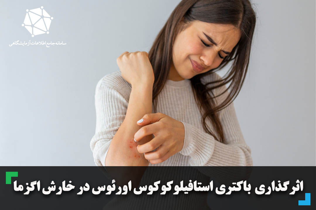 اثرگذاری باکتری استافیلوکوکوس اورئوس در خارش اگزما