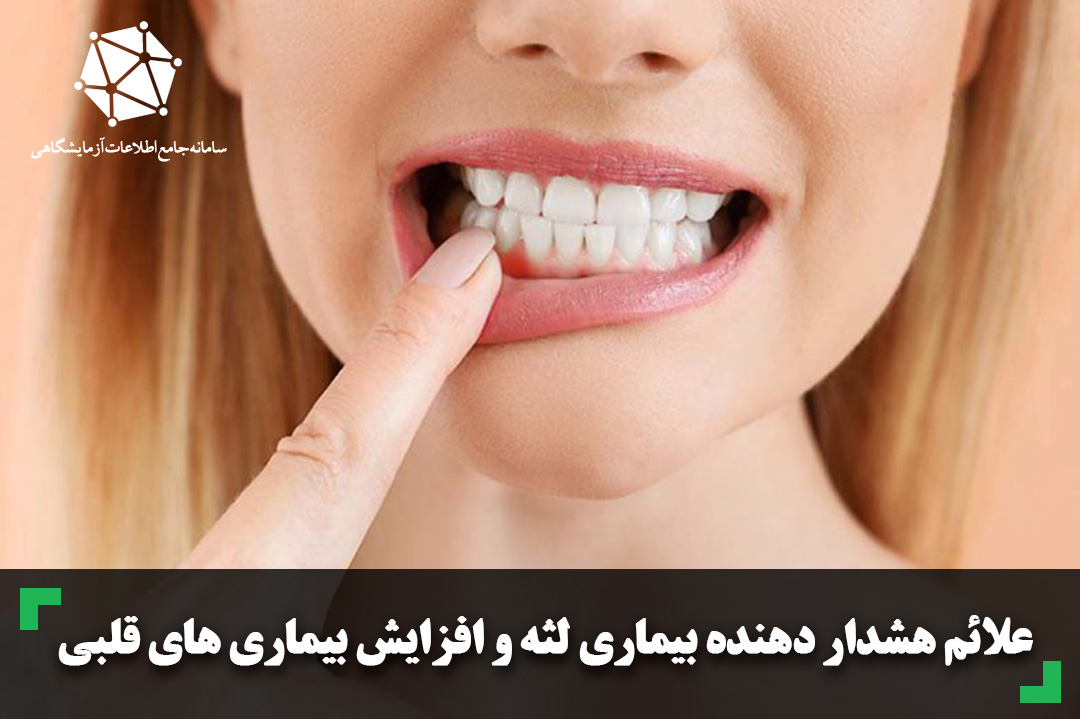 علائم هشداردهنده بیماری لثه و افزایش بیماری های قلبی